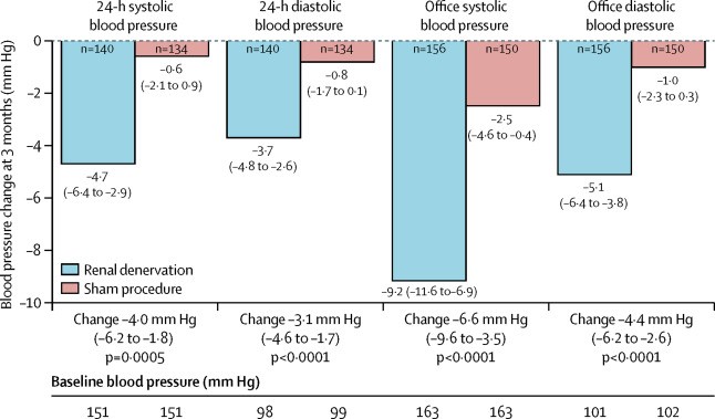 Efficacy of Catheter-Based Renal Denervation in the Absence of Antihypertensive Medications (SPYRAL HTN-OFF MED Pivotal): A Multicentre, Randomised, Sham-Controlled Trial